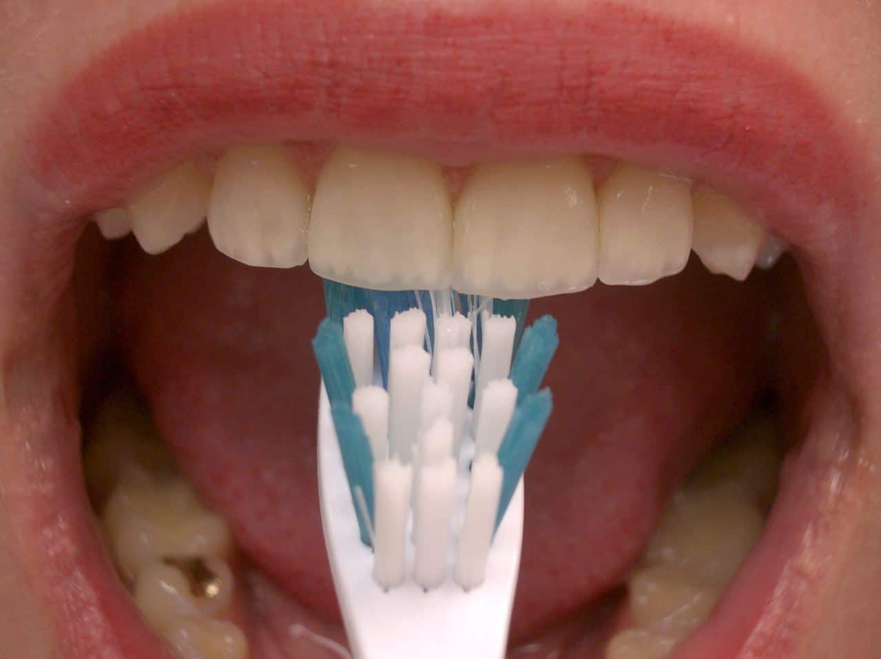 imgpsh fullsize anim 3 - Oral Hygiene