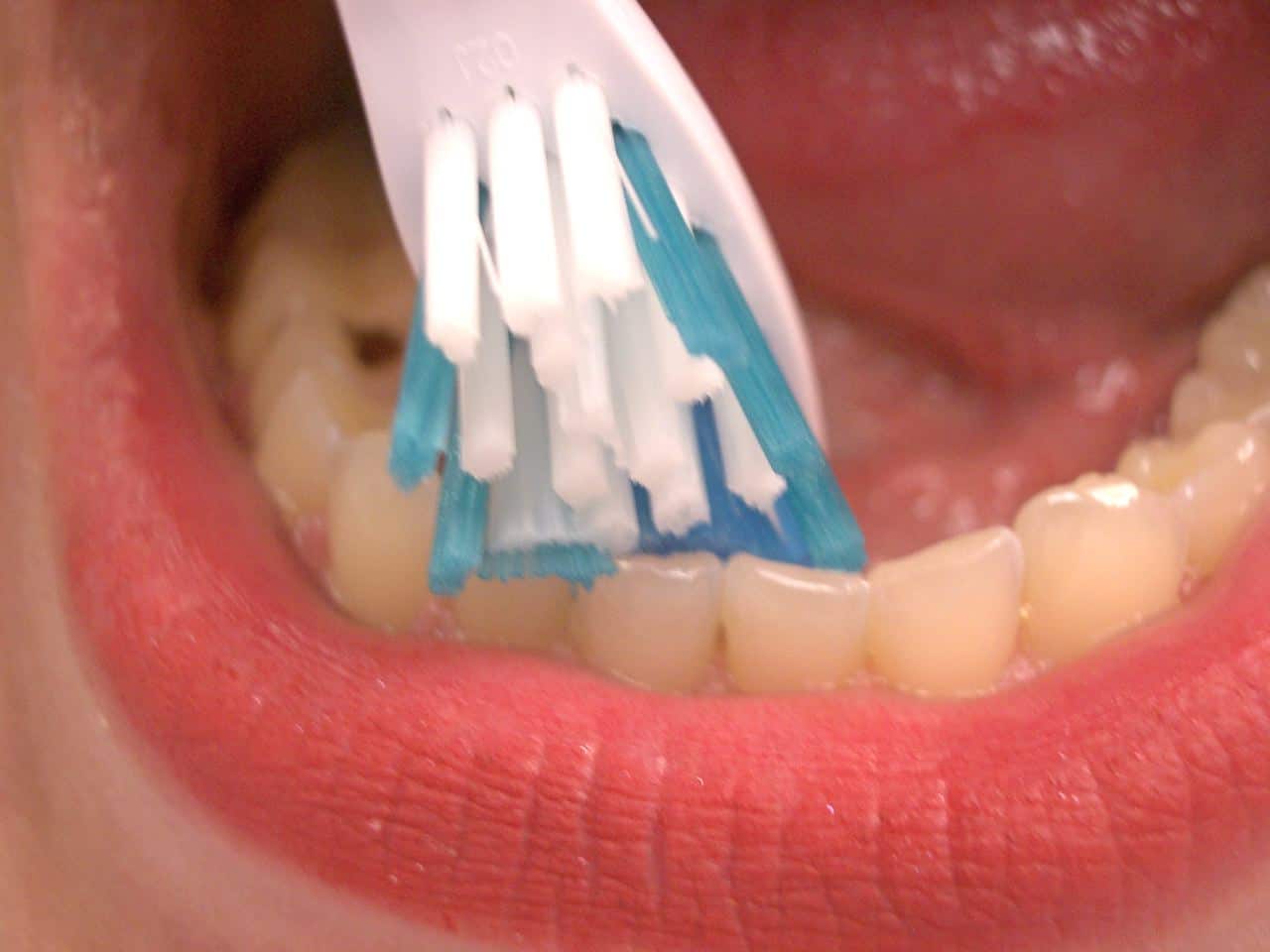 imgpsh fullsize anim 6 - Oral Hygiene