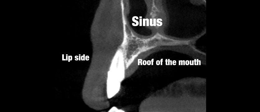 image four location - Dental CT Scan "CBCT"
